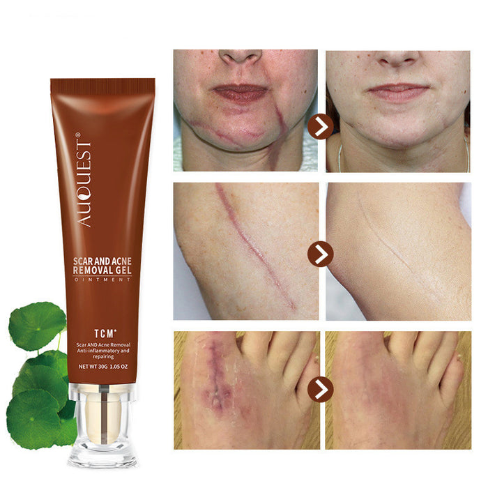 Moisturizing and repairing scar skin care cream